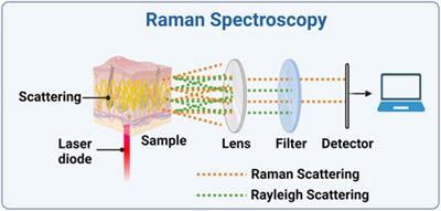 Is Raman the best strategy towards the development of non-invasive continuous glucose monitoring devices for diabetes management?